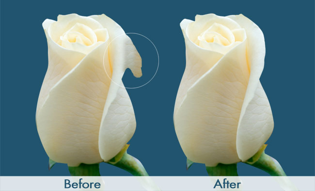 labiaplasty-rose-drawing-before-and-after-dr-hanna-la-nouvelle-oxnard-ventura